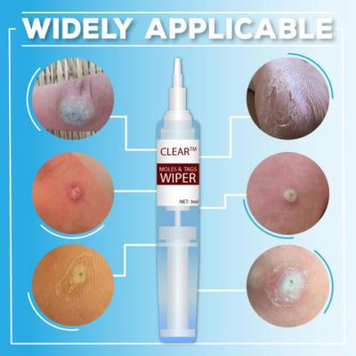 Clear Moles & Tag Wiper