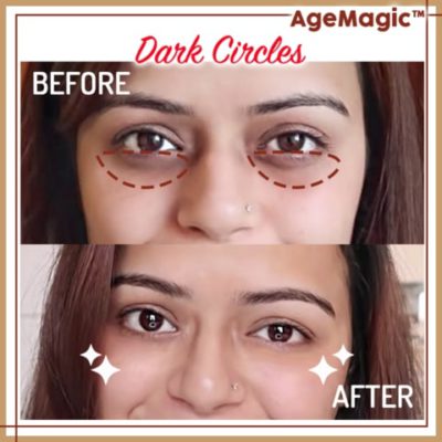 AgeMagic Instant Lifting Eye Cream