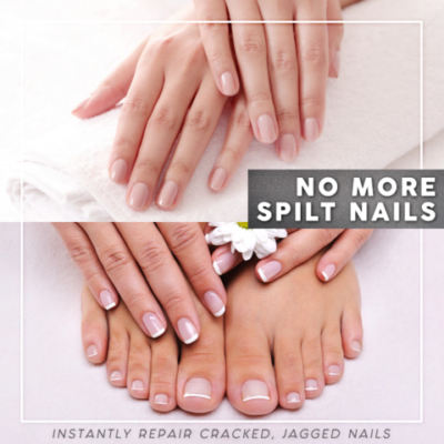 NailRescue Instant Nail Repair