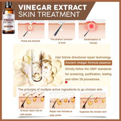 Vinegar Extract Skin Tightener