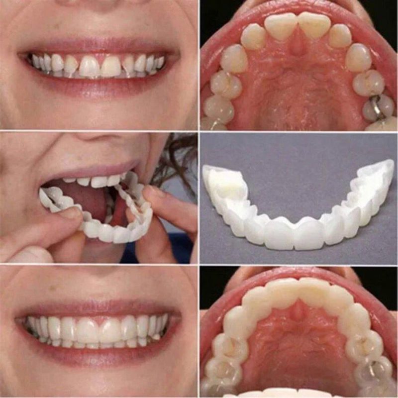 magical teeth braces