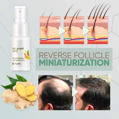 GingerGrowth Hair Regrow Spray,hair thinning,hair roots,hair growth,hair loss treatments