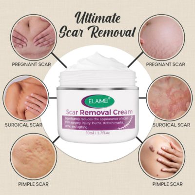 Organic Skin Rebound Cream,Skin Rebound Cream,Rebound Cream,Cream,Skin Rebound