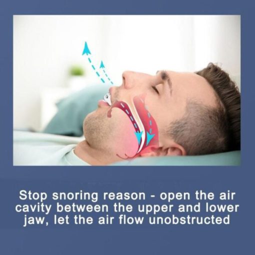 Silicone Braces,Anti-snoring Silicone,Anti-snoring,Braces