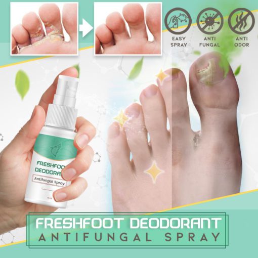 Antifungal Spray,Foot Deodorant,Fresh Foot,Spray,Antifungal