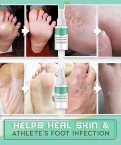 Antifungal Spray,Foot Deodorant,Fresh Foot,Spray,Antifungal