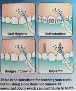 Dental Water Jet,Floss Dental Water Jet,Water Jet,Power Floss Dental Water Jet,Power Floss