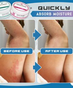 Heat Rash Repair Powder,Rash Repair,Rash Repair Powder