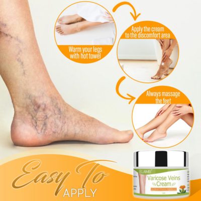 Organic Healing Cream for Varicose Vein,Varicose Vein,Organic Healing Cream,Healing Cream