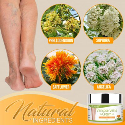 Organic Healing Cream for Varicose Vein,Varicose Vein,Organic Healing Cream,Healing Cream