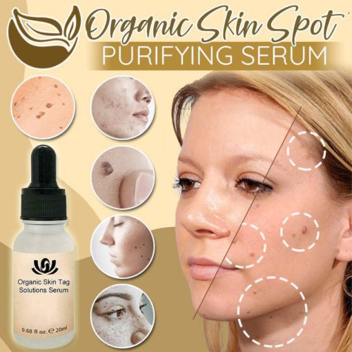 Organic Spot Free Serum,Purifying Serum,Skin Spot