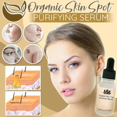 Organic Spot Free Serum,Purifying Serum,Skin Spot