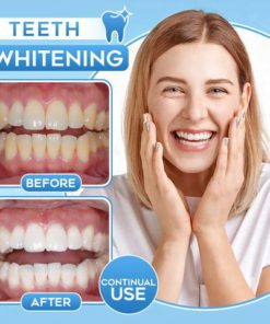 Whitening Essence,Teeth Whitening,Whitening,Teeth White