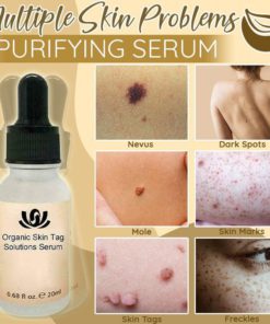 Organic Spot Free Serum,Purifying Serum,Skin Spot