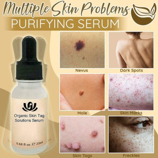 Organic Spot Free Serum,Purifying Serum,Skin Spot