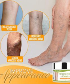 Vein Healing Cream,Organic Varicose Vein Healing Cream,Varicose Vein Healing Cream,Healing Cream,Cream