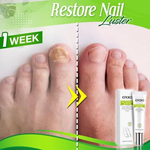 Toe Regeneration Beauty Gel,Regeneration Beauty Gel,Beauty Gel