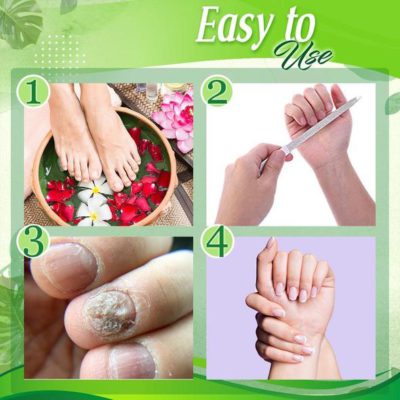 Toe Regeneration Beauty Gel,Regeneration Beauty Gel,Beauty Gel