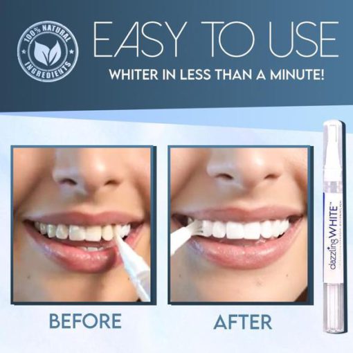 SwipeBright Instant Whitening Oral Pen,Instant Whitening Oral Pen,Whitening Oral Pen,Oral Pen,Instant Whitening Oral