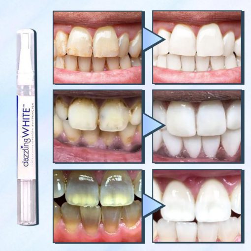 SwipeBright Instant Whitening Oral Pen,Instant Whitening Oral Pen,Whitening Oral Pen,Oral Pen,Instant Whitening Oral