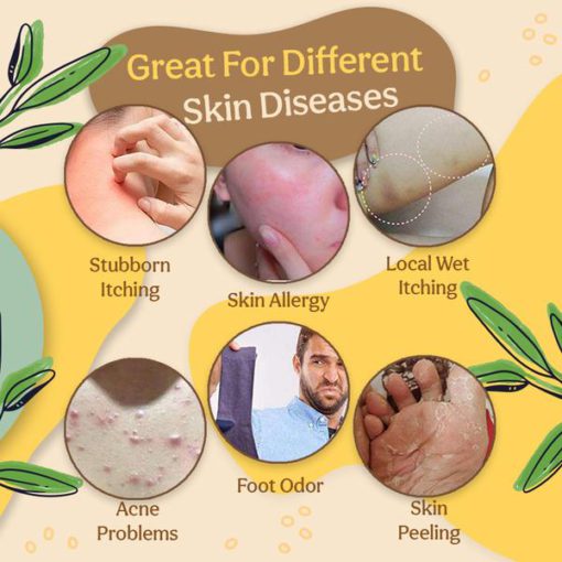 Organic Dermatitis Herbal Healing Cream,Dermatitis Herbal Healing Cream,Herbal Healing Cream,Healing Cream,Dermatitis Herbal Healing