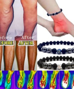 Anti Varicose,Swelling Magnetotherapy Anklet,Magnetotherapy Anklet,Swelling Magnetotherapy