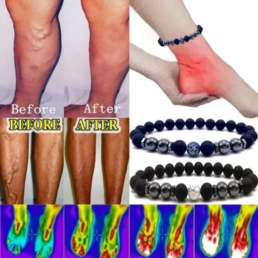 Anti Varicose,Swelling Magnetotherapy Anklet,Magnetotherapy Anklet,Swelling Magnetotherapy