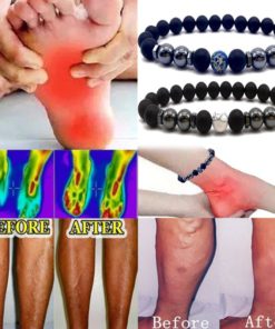 Anti Varicose,Swelling Magnetotherapy Anklet,Magnetotherapy Anklet,Swelling Magnetotherapy