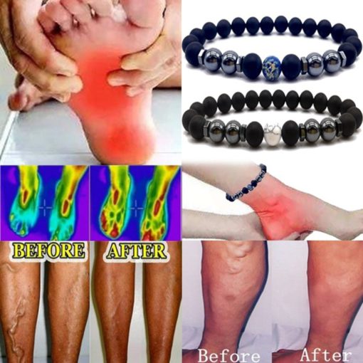 Anti Varicose,Swelling Magnetotherapy Anklet,Magnetotherapy Anklet,Swelling Magnetotherapy