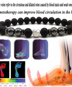 Anti Varicose,Swelling Magnetotherapy Anklet,Magnetotherapy Anklet,Swelling Magnetotherapy