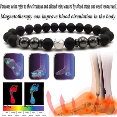 Anti Varicose,Swelling Magnetotherapy Anklet,Magnetotherapy Anklet,Swelling Magnetotherapy
