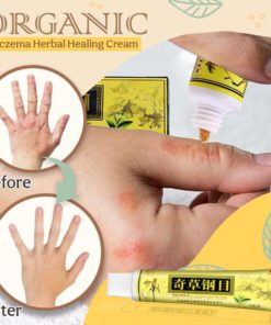 Organic Dermatitis Herbal Healing Cream,Dermatitis Herbal Healing Cream,Herbal Healing Cream,Healing Cream,Dermatitis Herbal Healing