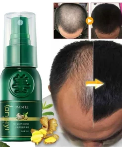 Hair Growth Spray,Growth Spray,Hair Growth,Ginger Hair Growth,Ginger Hair Growth Spray