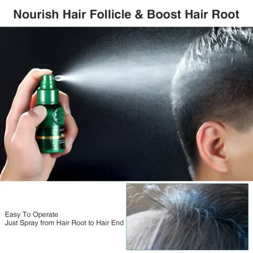 Hair Growth Spray,Growth Spray,Hair Growth,Ginger Hair Growth,Ginger Hair Growth Spray