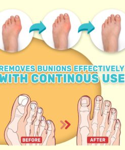 Relief Cream,Bunion Toe,Bunion Toe Stiffness Relief Cream