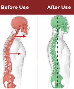 NeckHump CareRelief AidStretcher