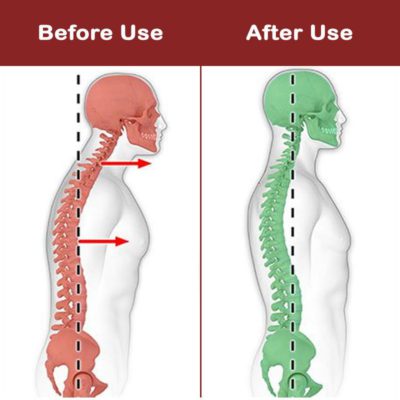 NeckHump CareRelief AidStretcher