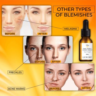 BlemishSkin Corrector Serum,Corrector serum