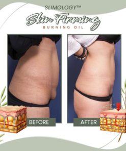 Belly Fat Burning Oil,Fat Burning Oil,Burning Oil,Belly Fat Burning,Slimology™ Belly Fat Burning Oil