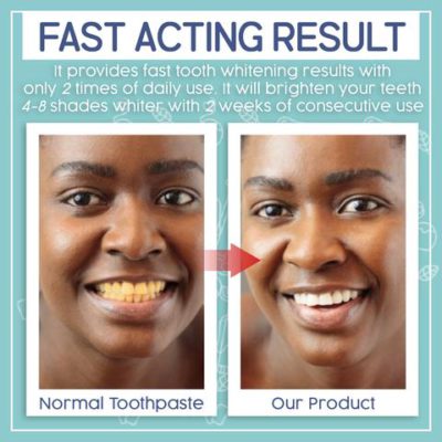 Ultra Whitening Toothpaste,Whitening Toothpaste,StainOut™ Ultra Whitening Toothpaste,StainOut Ultra Whitening Toothpaste