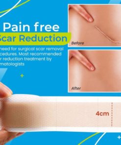 Gel Patch,Scar Removal Gel,Removal Gel,Scar Removal,Scar Removal Gel Patch