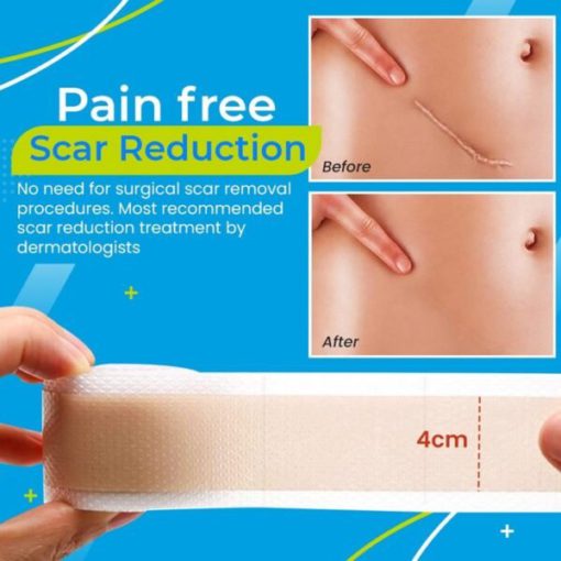 Gel Patch,Scar Removal Gel,Removal Gel,Scar Removal,Scar Removal Gel Patch