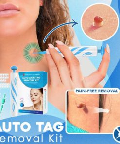 Tag Removal,Auto Tag,Auto Tag Removal Kit