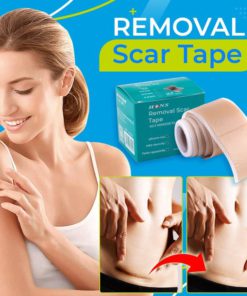 Gel Patch,Scar Removal Gel,Removal Gel,Scar Removal,Scar Removal Gel Patch