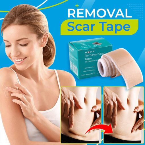 Gel Patch,Scar Removal Gel,Removal Gel,Scar Removal,Scar Removal Gel Patch