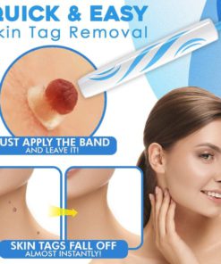 Tag Removal,Auto Tag,Auto Tag Removal Kit