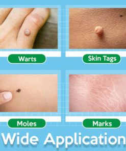 Skin Tag Remover,TagOff™ Skin Tag Remover