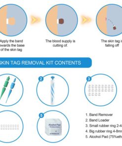 Skin Tag Removal Kit