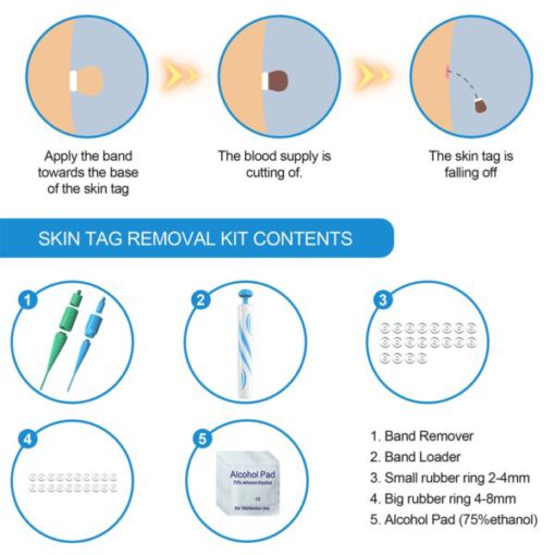 Skin Tag Removal Kit