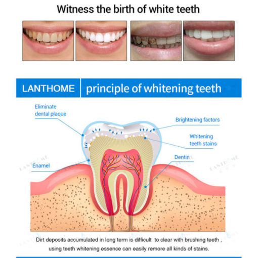 Teeth Whitening Pens